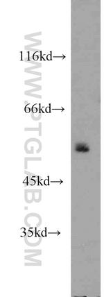 POLD2 Antibody in Western Blot (WB)