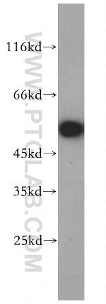 POLD2 Antibody in Western Blot (WB)