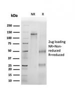 P16INK4a Antibody in SDS-PAGE (SDS-PAGE)