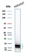 CDKN2A/p16INK4a/p14ARF Antibody in Western Blot (WB)