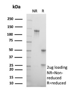 CDKN2A/p16INK4a/p14ARF Antibody in SDS-PAGE (SDS-PAGE)
