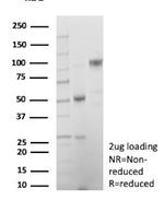CDKN2A/p16INK4a/p14ARF Antibody in SDS-PAGE (SDS-PAGE)