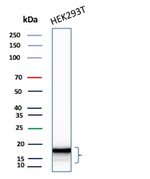 CDKN2A/p16INK4a/p14ARF Antibody in Western Blot (WB)