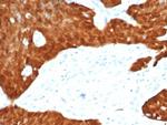 P16INK4a Recombinant Rabbit Monoclonal Antibody (CDKN2A/7081R)