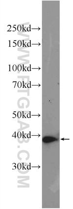 AMPK gamma 1 Antibody in Western Blot (WB)