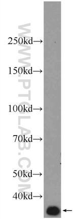 AMPK gamma 1 Antibody in Western Blot (WB)