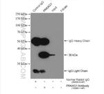 AMPK gamma 1 Antibody in Immunoprecipitation (IP)