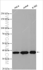 AMPK gamma 1 Antibody in Western Blot (WB)