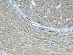 CCM3/PDCD10 Antibody in Immunohistochemistry (Paraffin) (IHC (P))