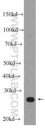 CCM3/PDCD10 Antibody in Western Blot (WB)