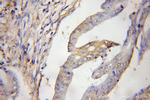 CCM3/PDCD10 Antibody in Immunohistochemistry (Paraffin) (IHC (P))