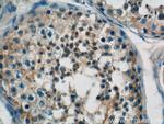 CIAO1 Antibody in Immunohistochemistry (Paraffin) (IHC (P))
