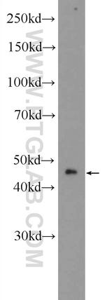 Aurora A Antibody in Western Blot (WB)