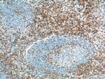CD2 Antibody in Immunohistochemistry (Paraffin) (IHC (P))