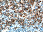 CD2 Antibody in Immunohistochemistry (Paraffin) (IHC (P))