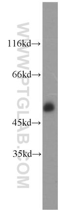 CD2 Antibody in Western Blot (WB)