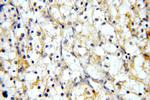 MME/CD10 Antibody in Immunohistochemistry (Paraffin) (IHC (P))