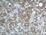 SNX1 Antibody in Immunohistochemistry (Paraffin) (IHC (P))