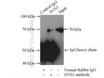 SNX1 Antibody in Immunoprecipitation (IP)