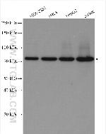 SNX1 Antibody in Western Blot (WB)