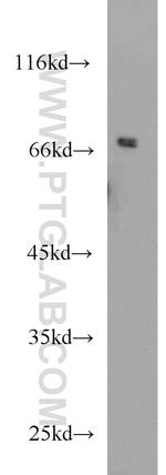 SNX1 Antibody in Western Blot (WB)