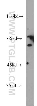 SNX1 Antibody in Western Blot (WB)