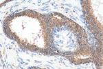 PLK1 Antibody in Immunohistochemistry (Paraffin) (IHC (P))