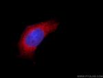 MPV17 Antibody in Immunocytochemistry (ICC/IF)