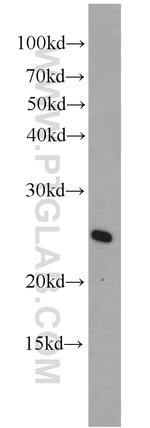 ARL4 Antibody in Western Blot (WB)