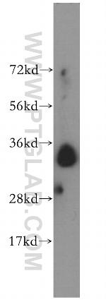 Stanniocalcin 2 Antibody in Western Blot (WB)