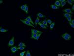Cathepsin H Antibody in Immunocytochemistry (ICC/IF)