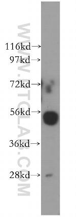 Cathepsin H Antibody in Western Blot (WB)