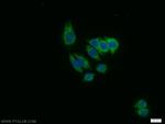 WBP11 Antibody in Immunocytochemistry (ICC/IF)