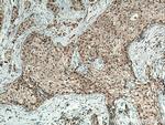 WBP11 Antibody in Immunohistochemistry (Paraffin) (IHC (P))