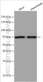 WBP11 Antibody in Western Blot (WB)