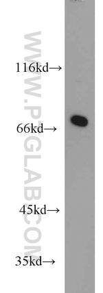 WBP11 Antibody in Western Blot (WB)