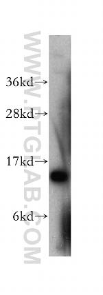 SMA4 Antibody in Western Blot (WB)