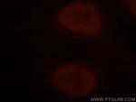 NUDT21 Antibody in Immunocytochemistry (ICC/IF)