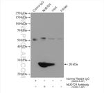 NUDT21 Antibody in Immunoprecipitation (IP)