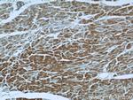 TRAP1 Antibody in Immunohistochemistry (Paraffin) (IHC (P))