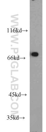 TRAP1 Antibody in Western Blot (WB)