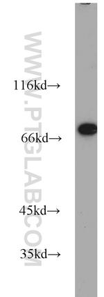 TRAP1 Antibody in Western Blot (WB)