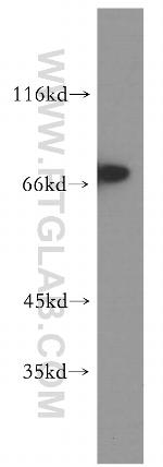 TRAP1 Antibody in Western Blot (WB)