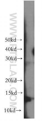 RAMP1 Antibody in Western Blot (WB)