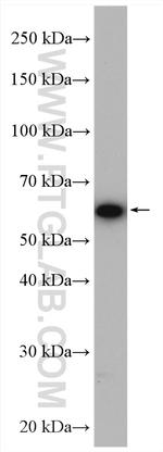 NXF1 Antibody in Western Blot (WB)