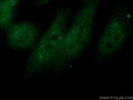 NXF1 Antibody in Immunocytochemistry (ICC/IF)