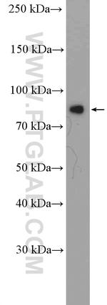Zyxin Antibody in Western Blot (WB)