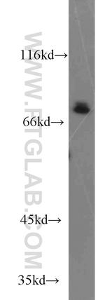Zyxin Antibody in Western Blot (WB)