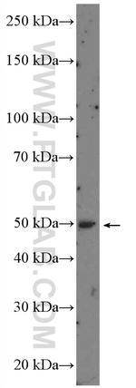 RARA Antibody in Western Blot (WB)