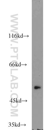 TRAIP Antibody in Western Blot (WB)